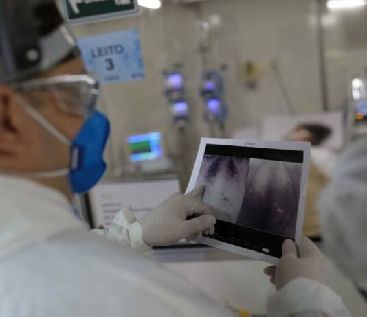 Juiz de Fora registra mais nove mortes e bate novo recorde de hospitalização